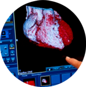 Heart Centers